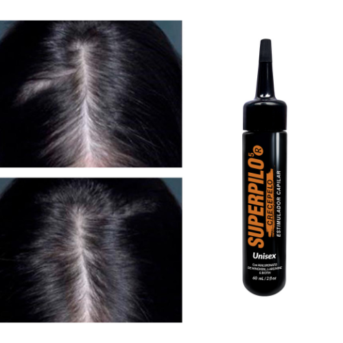 Bomba de Crecimiento Super Pilo CON MINOXIDIL 2%