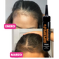 Bomba de Crecimiento Super Pilo CON MINOXIDIL 2%